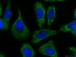 Alpha-1-Antitrypsin Antibody in Immunocytochemistry (ICC/IF)