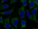 NAPRT1 Antibody in Immunocytochemistry (ICC/IF)