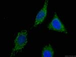 CNPY2, MSAP Antibody in Immunocytochemistry (ICC/IF)