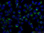 P62/SQSTM1 Antibody in Immunocytochemistry (ICC/IF)