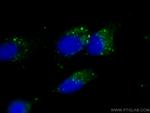 P62/SQSTM1 Antibody in Immunocytochemistry (ICC/IF)