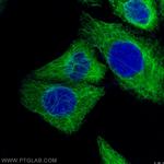 Cytokeratin 18 Antibody in Immunocytochemistry (ICC/IF)