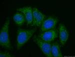 Apolipoprotein AI Antibody in Immunocytochemistry (ICC/IF)