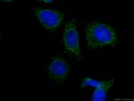 HPSE Antibody in Immunocytochemistry (ICC/IF)