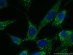 Adiponectin Antibody in Immunocytochemistry (ICC/IF)