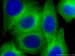 beta Tubulin Antibody in Immunocytochemistry (ICC/IF)