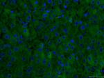 CRP Antibody in Immunohistochemistry (PFA fixed) (IHC (PFA))