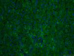 CRP Antibody in Immunohistochemistry (PFA fixed) (IHC (PFA))