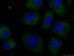 SRPX2 Antibody in Immunocytochemistry (ICC/IF)