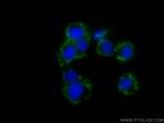 BDNF Antibody in Immunocytochemistry (ICC/IF)