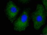 RSPO3 Antibody in Immunocytochemistry (ICC/IF)