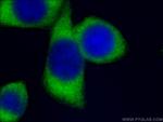 G6PD Antibody in Immunocytochemistry (ICC/IF)