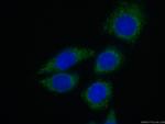 Cardiac Troponin I Antibody in Immunocytochemistry (ICC/IF)