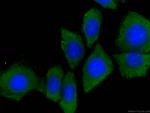 GSDMD Antibody in Immunocytochemistry (ICC/IF)