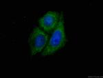 SIRT2 Antibody in Immunocytochemistry (ICC/IF)