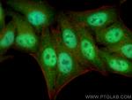 STAT5B Antibody in Immunocytochemistry (ICC/IF)