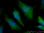 ADRM1 Antibody in Immunocytochemistry (ICC/IF)