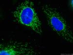 SOD2 Antibody in Immunocytochemistry (ICC/IF)