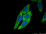 EIF2A/CDA02 Antibody in Immunocytochemistry (ICC/IF)