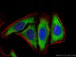 CLTC Antibody in Immunocytochemistry (ICC/IF)