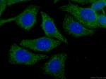 CLTC Antibody in Immunocytochemistry (ICC/IF)