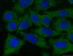 CNOT1 Antibody in Immunocytochemistry (ICC/IF)