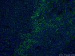 FCGR2A / CD32a Antibody in Immunohistochemistry (PFA fixed) (IHC (PFA))