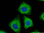 EXOC3L2 Antibody in Immunocytochemistry (ICC/IF)