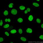 XRCC5 Antibody in Immunocytochemistry (ICC/IF)