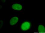 SMARCA4 Antibody in Immunocytochemistry (ICC/IF)