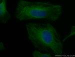 AMPK Beta 2 Antibody in Immunocytochemistry (ICC/IF)