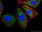 SDHA Antibody in Immunocytochemistry (ICC/IF)