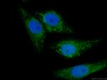 SDHA Antibody in Immunocytochemistry (ICC/IF)