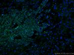 MLKL Antibody in Immunohistochemistry (PFA fixed) (IHC (PFA))