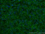 OCIAD1 Antibody in Immunohistochemistry (PFA fixed) (IHC (PFA))