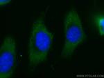 MTAP Antibody in Immunocytochemistry (ICC/IF)