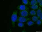 MTAP Antibody in Immunocytochemistry (ICC/IF)