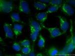 TPT1 Antibody in Immunocytochemistry (ICC/IF)