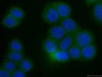 RHOA Antibody in Immunocytochemistry (ICC/IF)