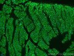 Dystroglycan Antibody in Immunohistochemistry (PFA fixed) (IHC (PFA))