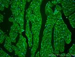 Dystroglycan Antibody in Immunohistochemistry (PFA fixed) (IHC (PFA))