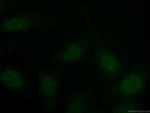 SRF Antibody in Immunocytochemistry (ICC/IF)