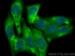 IRF5 Antibody in Immunocytochemistry (ICC/IF)