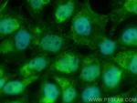 MBNL1 Antibody in Immunocytochemistry (ICC/IF)