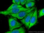 TFPI Antibody in Immunocytochemistry (ICC/IF)