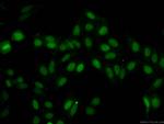 ASF1A Antibody in Immunocytochemistry (ICC/IF)