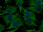 DLC1 Antibody in Immunocytochemistry (ICC/IF)