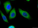 Calnexin Antibody in Immunocytochemistry (ICC/IF)