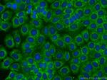 PARD3 Antibody in Immunocytochemistry (ICC/IF)