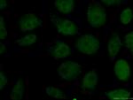 NBN Antibody in Immunocytochemistry (ICC/IF)